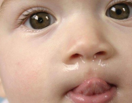Tổng hợp 10 cách trị sổ mũi cho bé theo phương pháp dân gian vô cùng hiệu quả